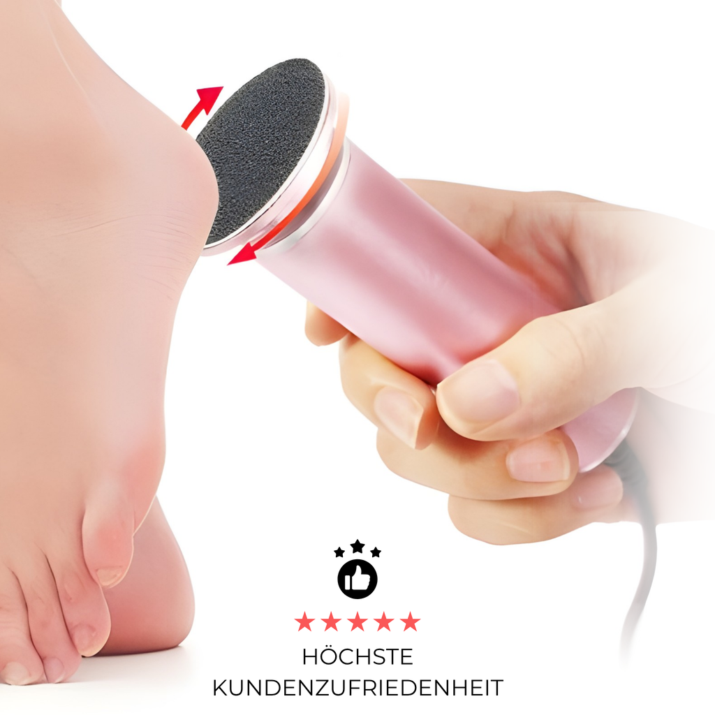 SkinFree™ elektrischer Hornhautentferner