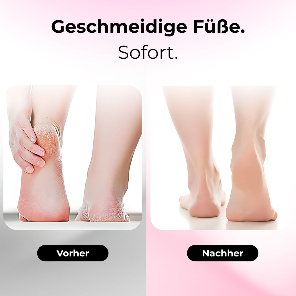 SkinFree™ - 2in1  Elektrischer Hornhautentferner & Nagelpolierer